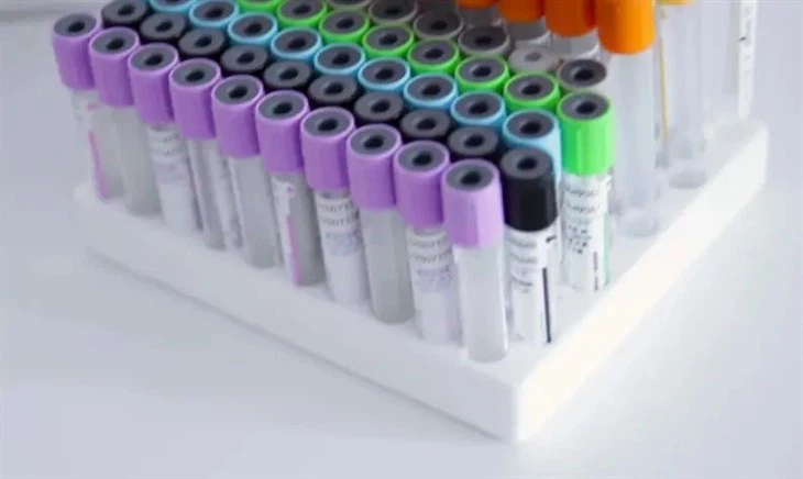 iv administration set for blood transfusion factory(001)